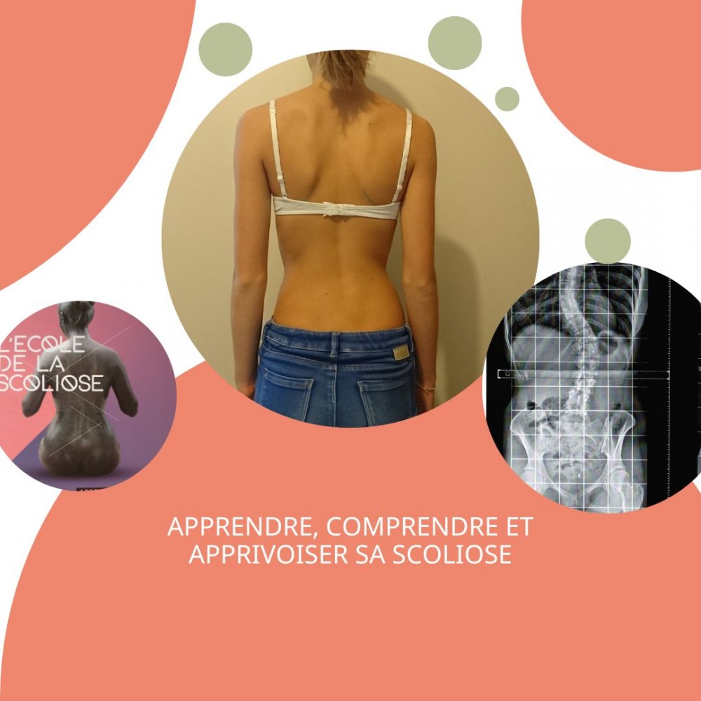 École de la scoliose 